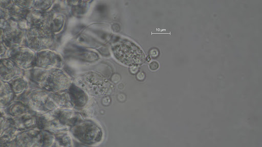 Globose spores on a basidia from Amanita sp. Photo: Mike Hensley